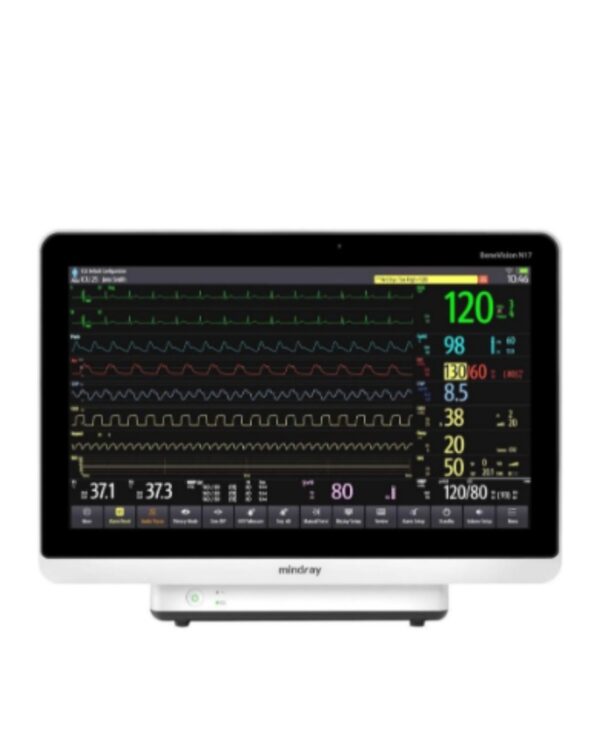 Monitor de paciente